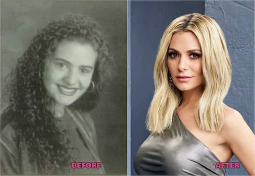 Dorit Kemsley pred a po